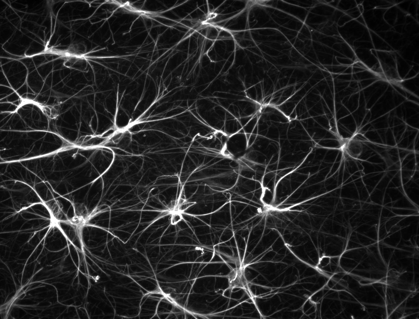 A fluorescence micrograph of cultured mouse hippocampal astrocytes, their star-shaped cell bodies and long branching processes glowing white against a black background after immunostaining for glial fibrillary acidic protein