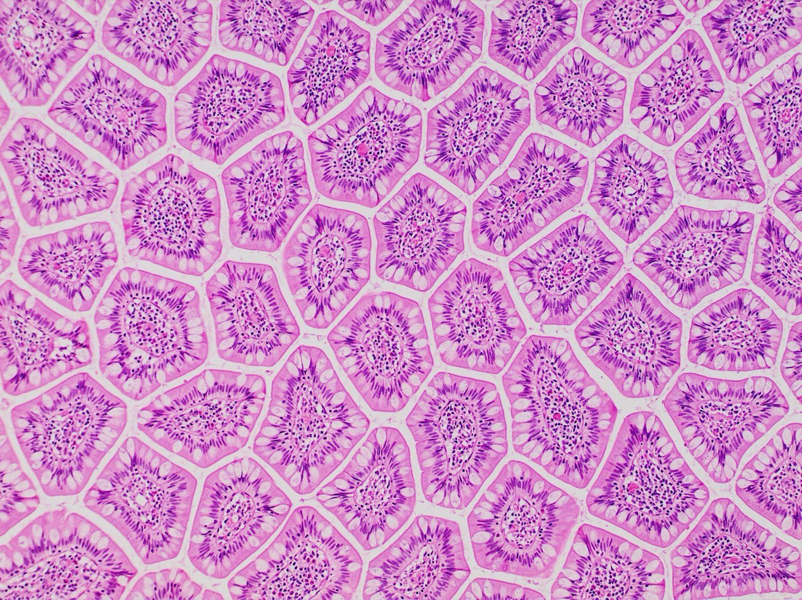 A stained microscope cross-section of human small-intestine tissue from the terminal ileum, showing finger-like villi lined with a single layer of pink-purple epithelial cells rising from the tissue below
